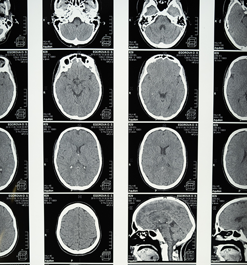 Multiple x-ray images of a brain